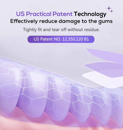 VioletSmile™ Whitening Strips