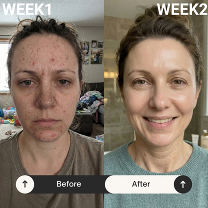 Nuvéra™ - Hydrogel Face Masks