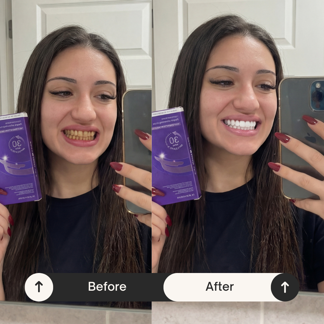 VioletSmile™ Whitening Strips