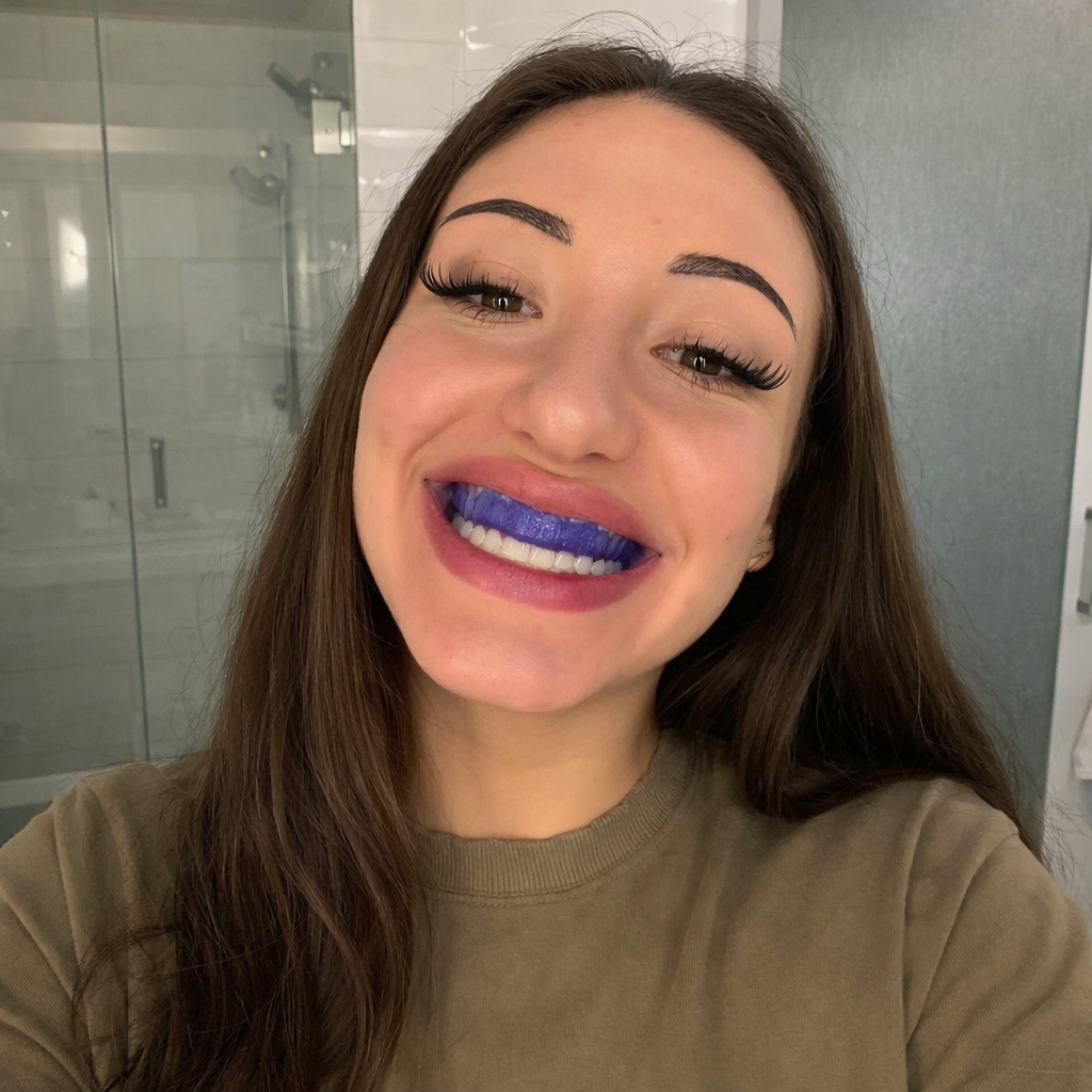 VioletSmile™ Whitening Strips